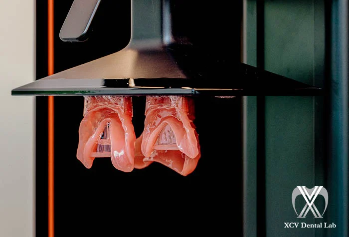 3D-printed acrylic dentures on dental model